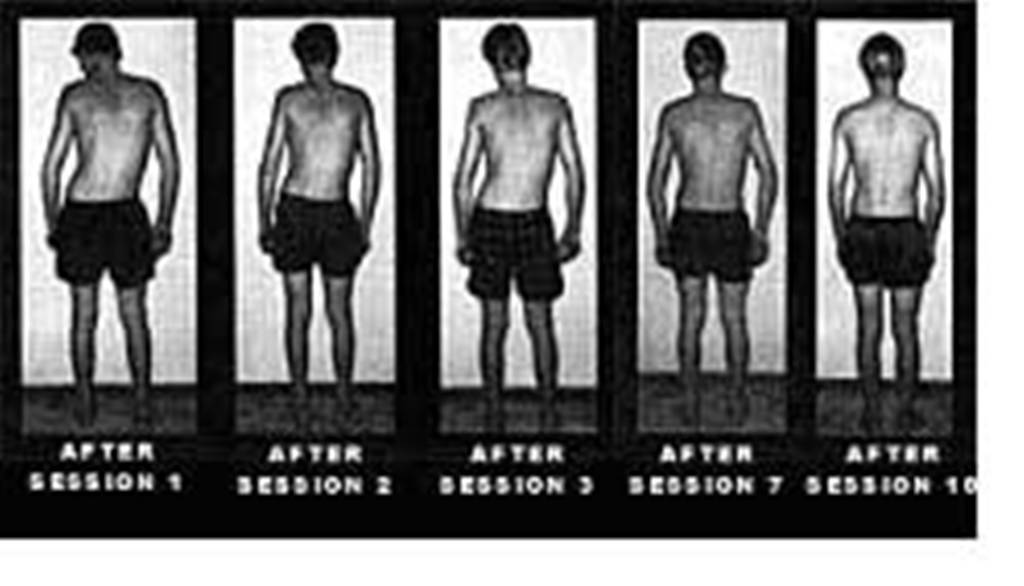 Rolfing Series Changes Photos